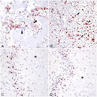 Canine soft tissue sarcomas: the expression of RUNX2 and karyopherin alpha-2 in extraskeletal (soft tissues) and skeletal osteosarcomas